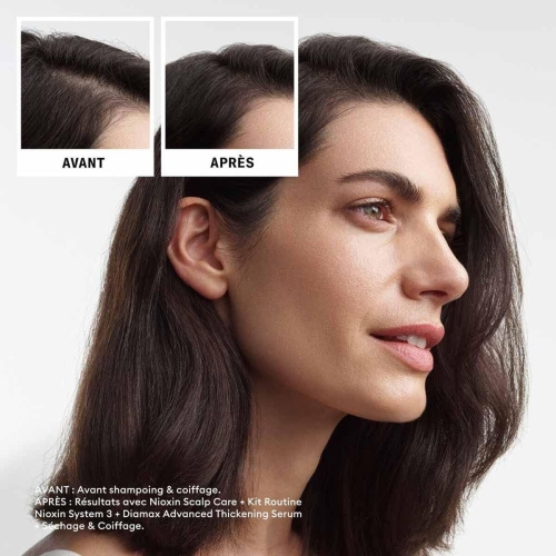 Shampoo and Conditioner Nioxin