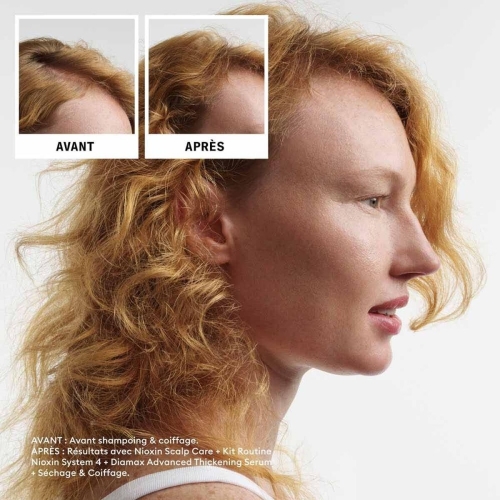 Shampoo and Conditioner Nioxin
