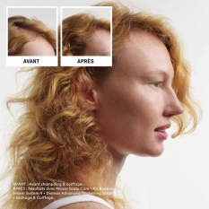 Shampoo and Conditioner Nioxin
